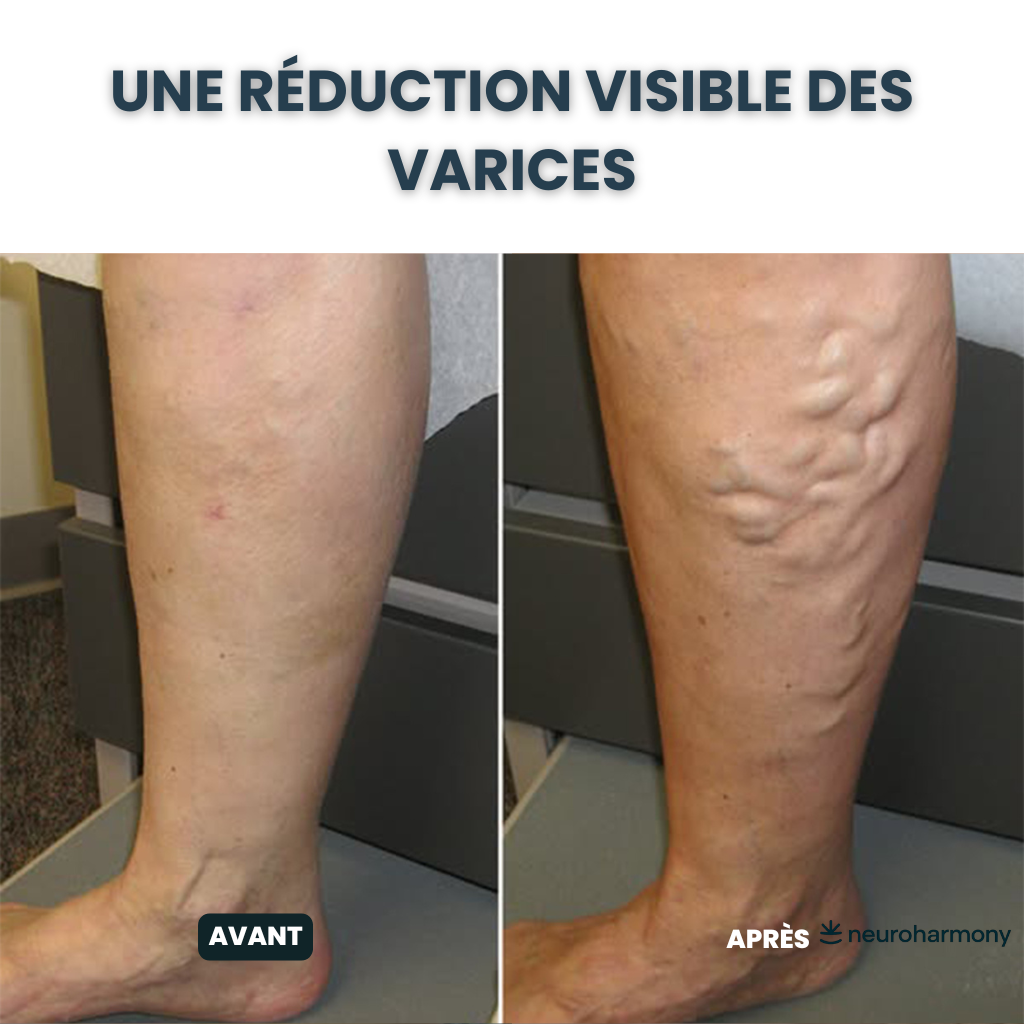 Neuroharmony – Retrouvez le confort nerveux au quotidien, naturellement